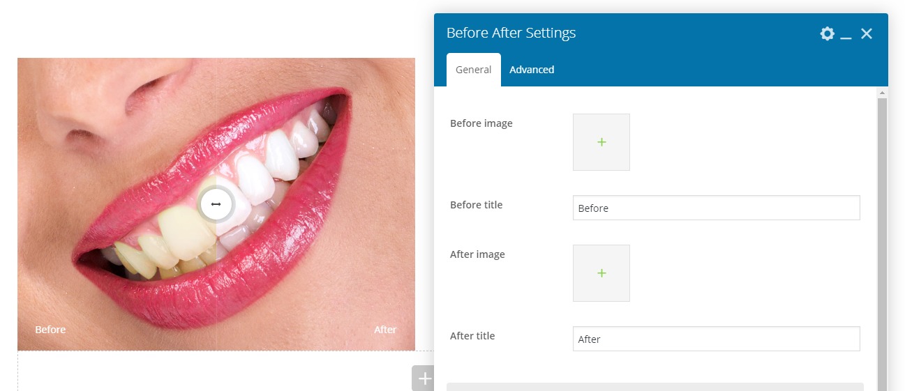 Before_after Before_after